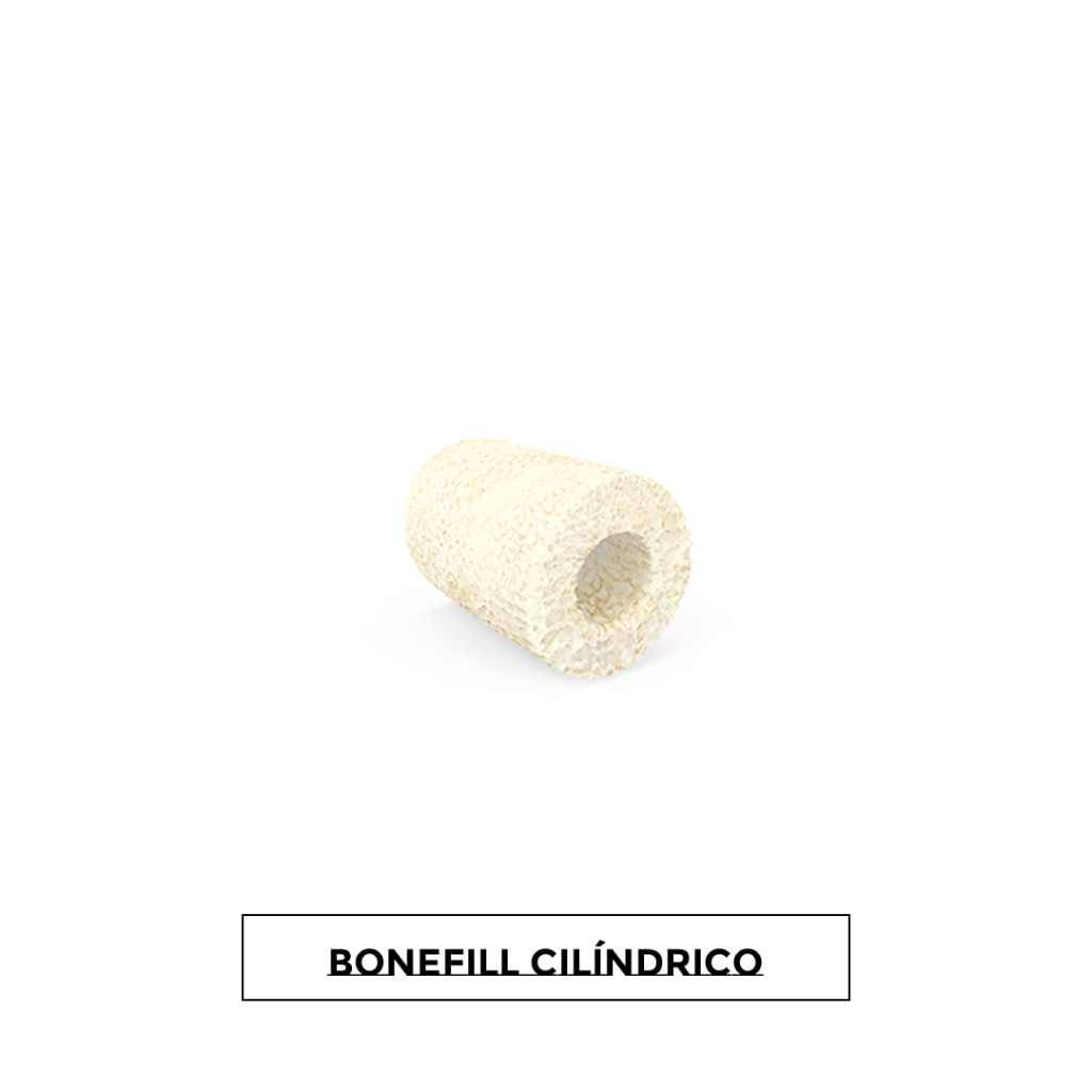 BONEFILL POROUS CILINDRICO 6X10MM